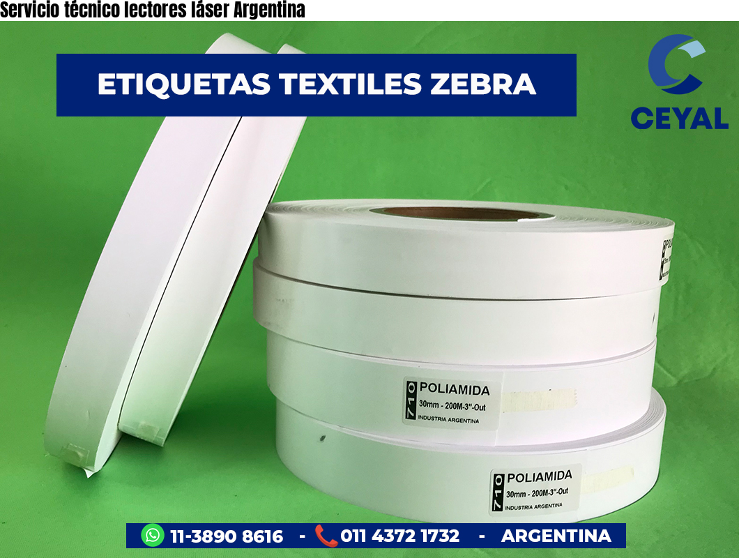 Servicio técnico lectores láser Argentina
